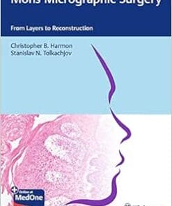 Mohs Micrographic Surgery: From Layers To Reconstruction (EPUB)