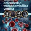 Compendio De Enfermedad Tromboembólica Venosa, 2.ª Edición (PDF)