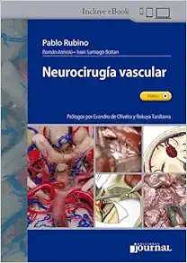 Neurocirugía Vascular (Videos)