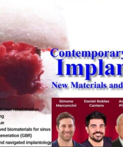 OHI-S Contemporary Advances in Implantology New Materials and Updated Protocols