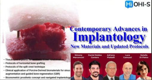 OHI-S Contemporary Advances in Implantology New Materials and Updated Protocols