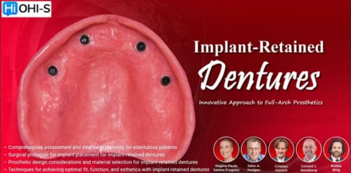 OHI-S Implant-Retained Dentures Innovative Approach to Full-Arch Prosthetics