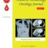 Pediatric Hematology Oncology Journal PDF