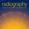 Radiography PDF