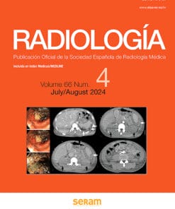 Radiología (English Edition) PDF