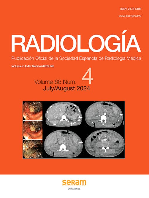 Radiología (English Edition) PDF