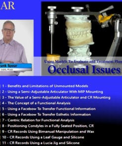 SPEAR Using Models To Evaluate and Treatment Plan Occlusal Issues – Frank Spear