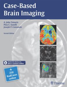 Discover the Best Free Radiology Books Available Online: 2024 Complete Guide