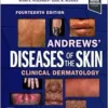 Andrews’ Diseases Of The Skin: Clinical Dermatology, 14th Edition (EPUB)