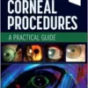 In-Office Corneal Procedures: A Practical Guide (True PDF)