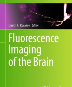 Fluorescence Imaging of the Brain