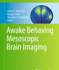 Awake Behaving Mesoscopic Brain Imaging