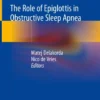 The Role of Epiglottis in Obstructive Sleep Apnea