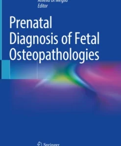 Prenatal Diagnosis of Fetal Osteopathologies