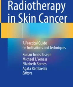 Radiotherapy in Skin Cancer
A Practical Guide on Indications and Techniques