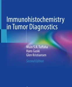 Immunohistochemistry in Tumor Diagnostics