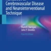 Handbook of Cerebrovascular Disease and Neurointerventional Technique