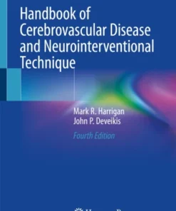 Handbook of Cerebrovascular Disease and Neurointerventional Technique