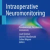 Intraoperative Neuromonitoring
Fundamentals, Possibilities, Limitations