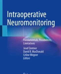 Intraoperative Neuromonitoring
Fundamentals, Possibilities, Limitations