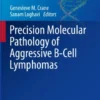 Precision Molecular Pathology of Aggressive B-Cell Lymphomas