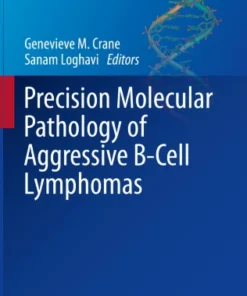 Precision Molecular Pathology of Aggressive B-Cell Lymphomas