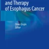 Risk Factors and Therapy of Esophagus Cancer