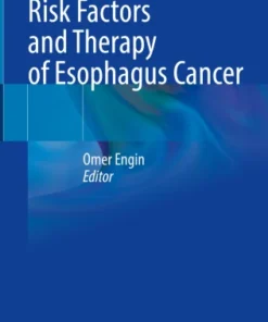 Risk Factors and Therapy of Esophagus Cancer