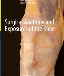 Surgical Anatomy and Exposures of the Knee
A Surgical Atlas