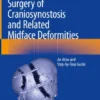 Surgery of Craniosynostosis and Related Midface Deformities
An Atlas and Step-by-Step Guide