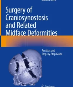 Surgery of Craniosynostosis and Related Midface Deformities
An Atlas and Step-by-Step Guide