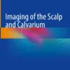 Imaging of the Scalp and Calvarium