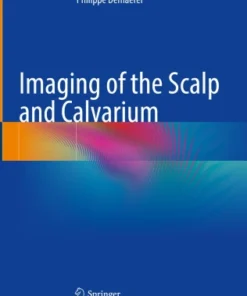 Imaging of the Scalp and Calvarium