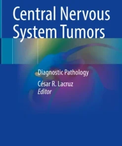 Central Nervous System Tumors
Diagnostic Pathology