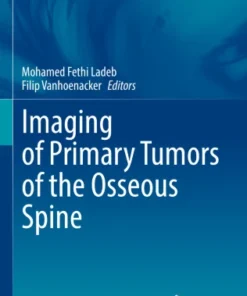 Imaging of Primary Tumors of the Osseous Spine