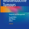 Neuroendocrine Tumours
Diagnosis and Management