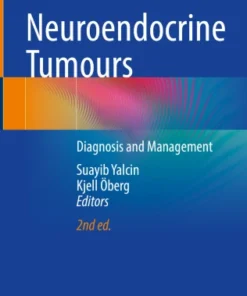 Neuroendocrine Tumours
Diagnosis and Management