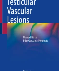 Testicular Vascular Lesions-