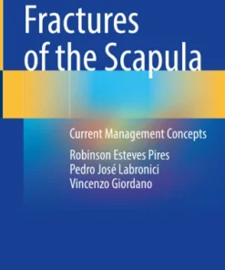 Fractures of the Scapula
Current Management Concepts