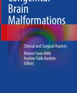 Congenital Brain Malformations
Clinical and Surgical Aspects