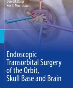 Endoscopic Transorbital Surgery of the Orbit, Skull Base and Brain