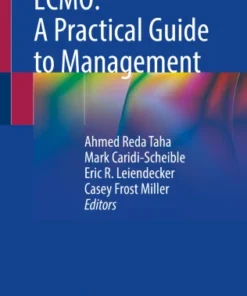 ECMO: A Practical Guide to Management-