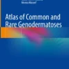 Atlas of Common and Rare Genodermatoses