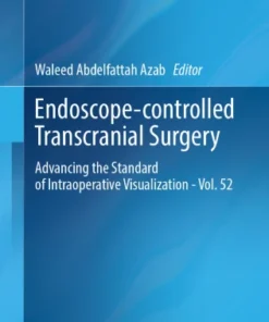 Endoscope-controlled Transcranial SurgeryrAdvancing the Standard of Intraoperative Visualization – Vol. 52