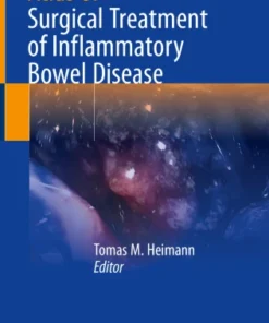 Atlas of Surgical Treatment of Inflammatory Bowel Disease