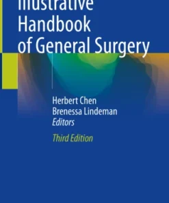 Illustrative Handbook of General Surgery