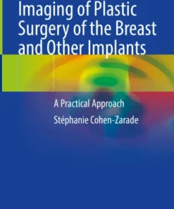 Imaging of Plastic Surgery of the Breast and Other Implants
A Practical Approach