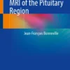 Tricks and Traps in MRI of the Pituitary Region-