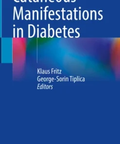 Cutaneous Manifestations in Diabetes