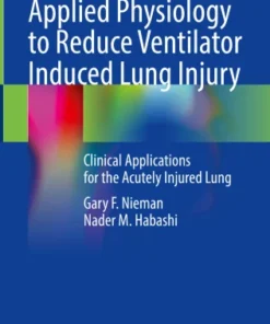 Applied Physiology to Reduce Ventilator Induced Lung Injury
Clinical Applications for the Acutely Injured Lung